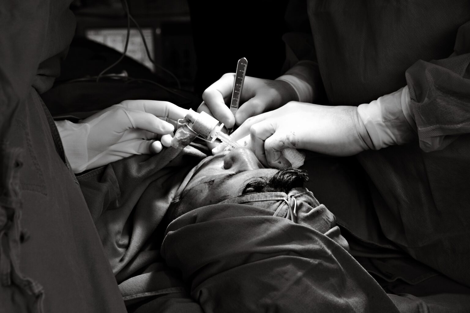 Breathing Easier With Balloon Sinuplasty and What to Expect